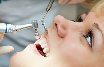 Professional Teeth Cleaning Toronto at Dentists on Bloor