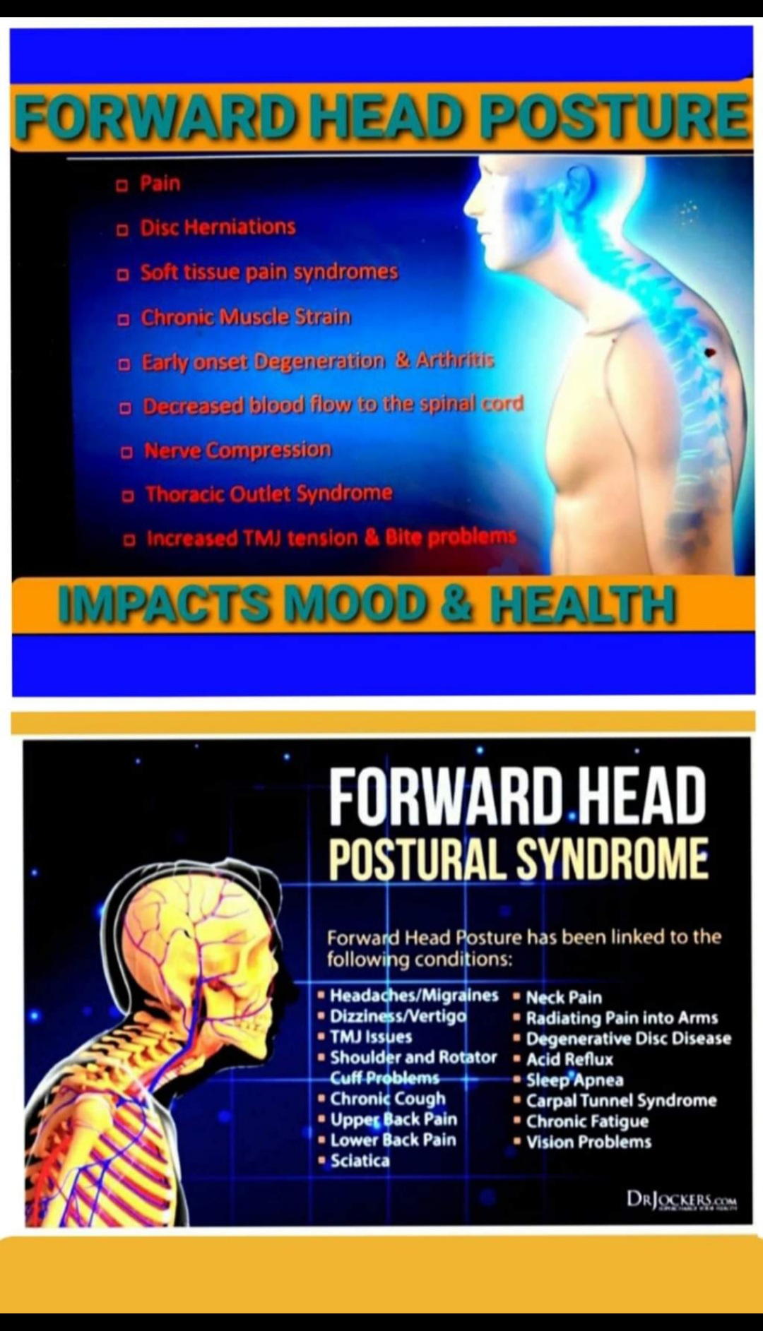 Spinal Alignment/Wellness & Nerve Plexi Focus Milwaukee