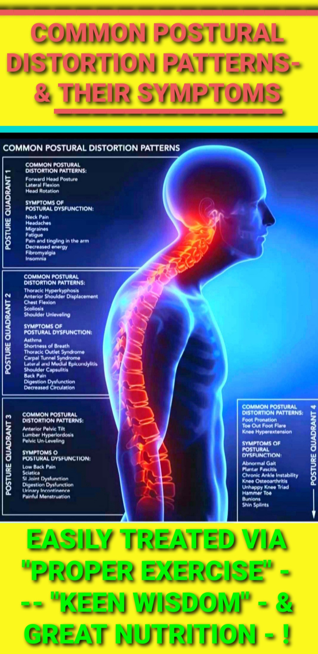 Common Postural Distortion Patterns and Symptoms by Better Results Personal Training