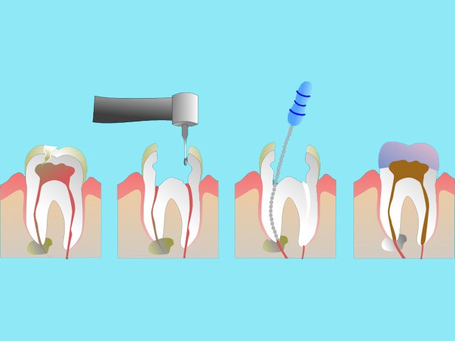 Dental Hygienists Toronto