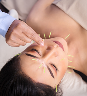 Microneedling Melbourne