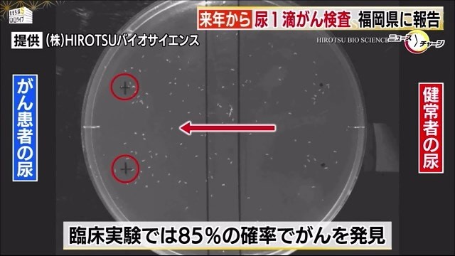 日本有企业研发出用1滴尿验出乳癌、大肠癌等15种癌症,声称准确率达85%。