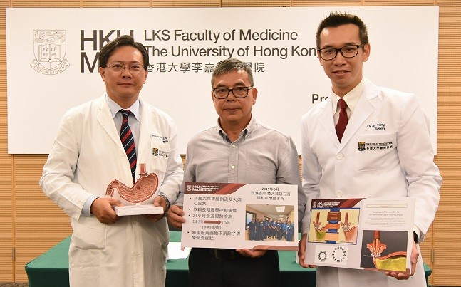港大医学院完成亚洲首宗以植入式磁石环增强下食道括约肌功能手术以治疗胃酸倒流。