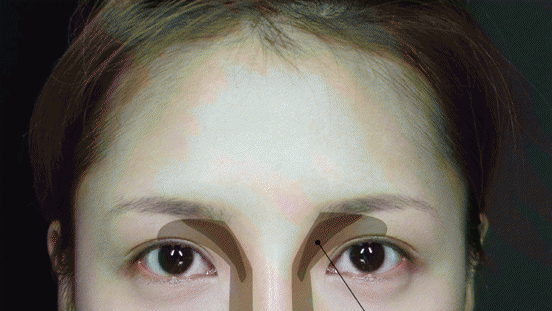 contouring