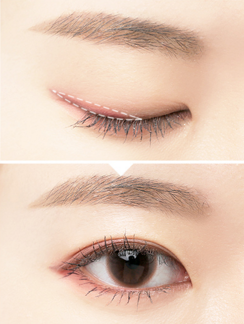 eye
