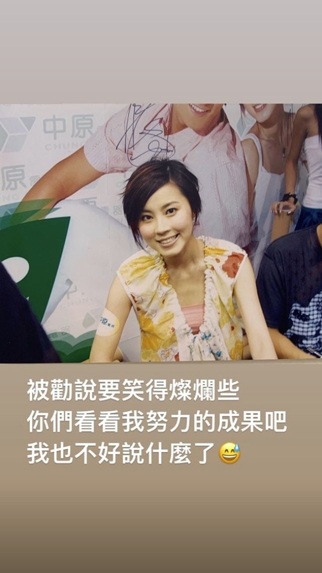 Theresa傅穎整容V面間尺鼻膠樣，出道進化史