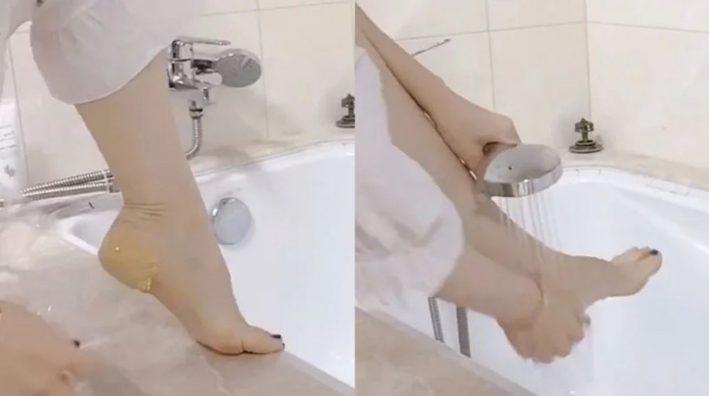 腳踭「去角質膜」