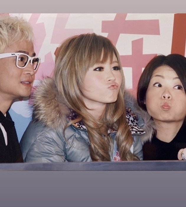 Theresa傅穎整容V面間尺鼻膠樣，出道進化史