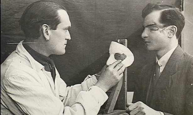 English army medical officed making a mould for a soldier's facial injury- Public Domain_Australian War Memorial (1) ref link : http://www.theguardian.com/world/postcolonial/2014/may/26/broken-gargoyles-the-disfigured-soldiers-of-the-first-world-war