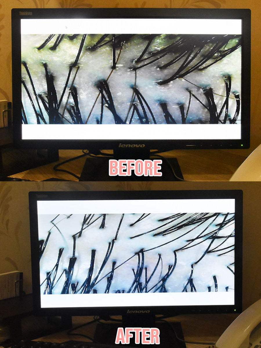 before after