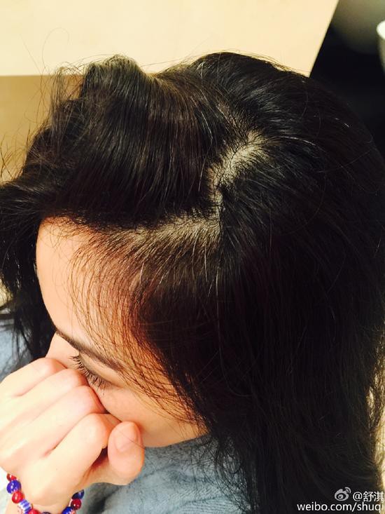 Weibo