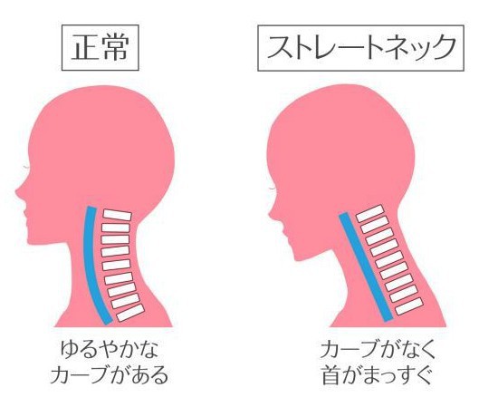 Screen Shot 2018-08-17 at 6.21.02 PM