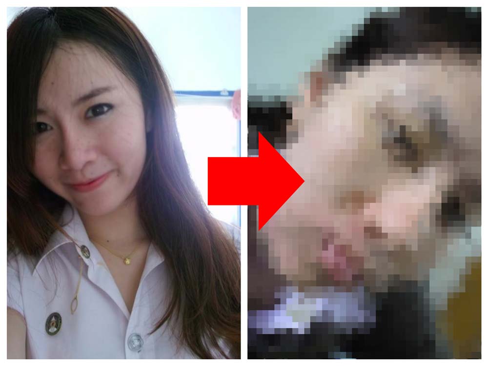 image of อุทาหรณ์...อยากหน้าขาวใส...แต่กลับหน้าเละแบบนี้?!!