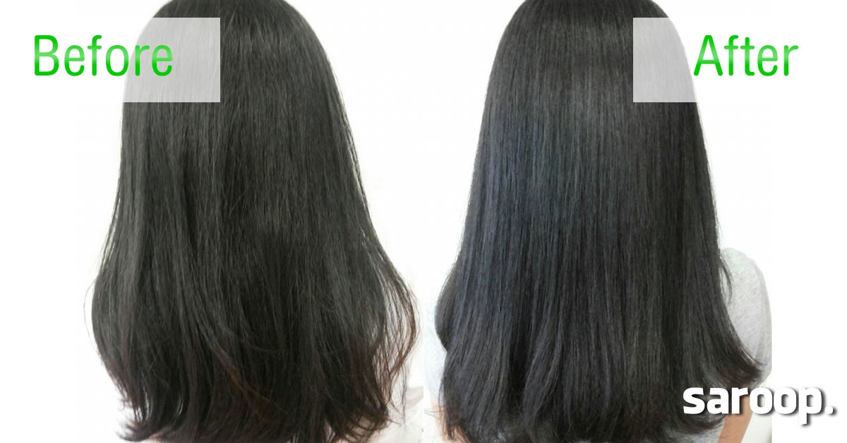 image of Review: สิวผดหายพร้อมบำรุงเส้นผมด้วยแชมพูปราศจากซิลิโคน