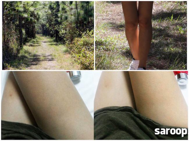 image of Before&After: ประสบการณ์ผิวเสียซ่อมยากของสาววัย 30