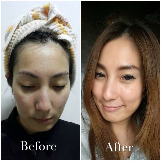 image of ผิวหน้ากระชับกระจ่างใสด้วยแอสตาแซนธิน (Astaxanthin)