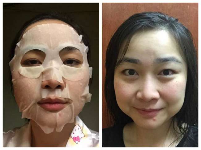 image of รีวิว Clear Turn Q10 Essense Mask By Kose ผิวหน้าขาวใส สู้แดดซัมเมอร์