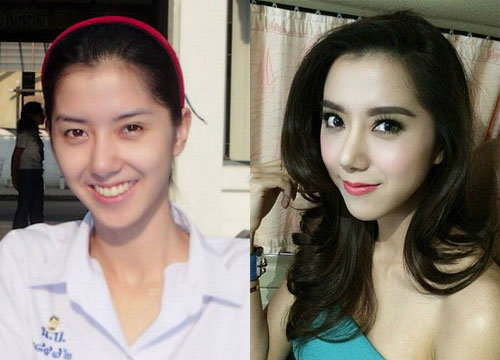 image of 10 ดาราสาวทำจมูกแล้วสวยเจิด...เป๊ะเว่อร์!!