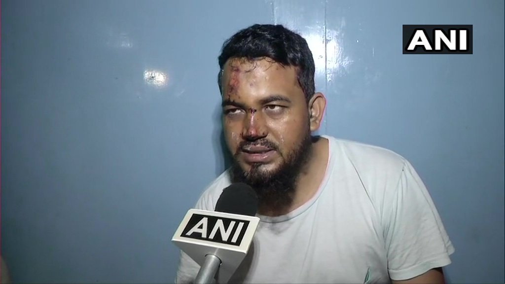 محمد مومن، جن کا الزام ہے کہ ان کو جئے شری رام نہ بولنے کی وجہ سے کار سے ٹکر مار دی گئی (فوٹو: اے این آئی)