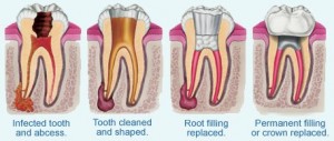 Blog by Dentists on Bloor