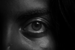 The eye