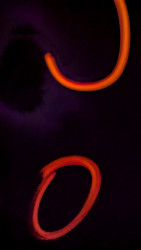 TM01 Dinul Jayasinghe Burn