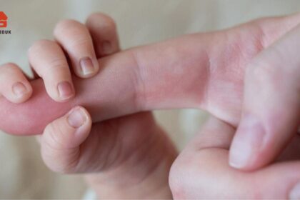 Cek Produk - 7 Cara Efektif Mengatasi Kulit Kering Bayi: Panduan Lengkap Orang Tua