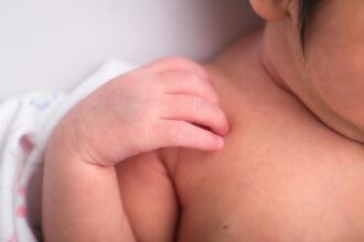 Cek Produk - 10 Produk Salep Terbaik untuk Meredakan Ruam Kulit Bayi