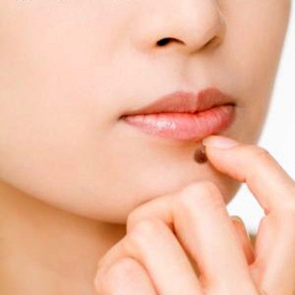 Moles Warts And Skin Tags Removal In Karkhana Moles Warts And Skin moles-warts-and-skin-tags-removal-in-karkhana-moles-warts-and-skin