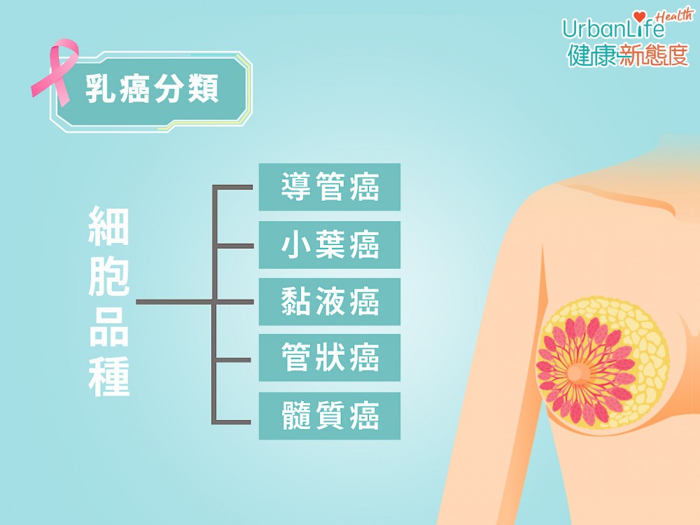 乳癌可根據「細胞品種」細分。