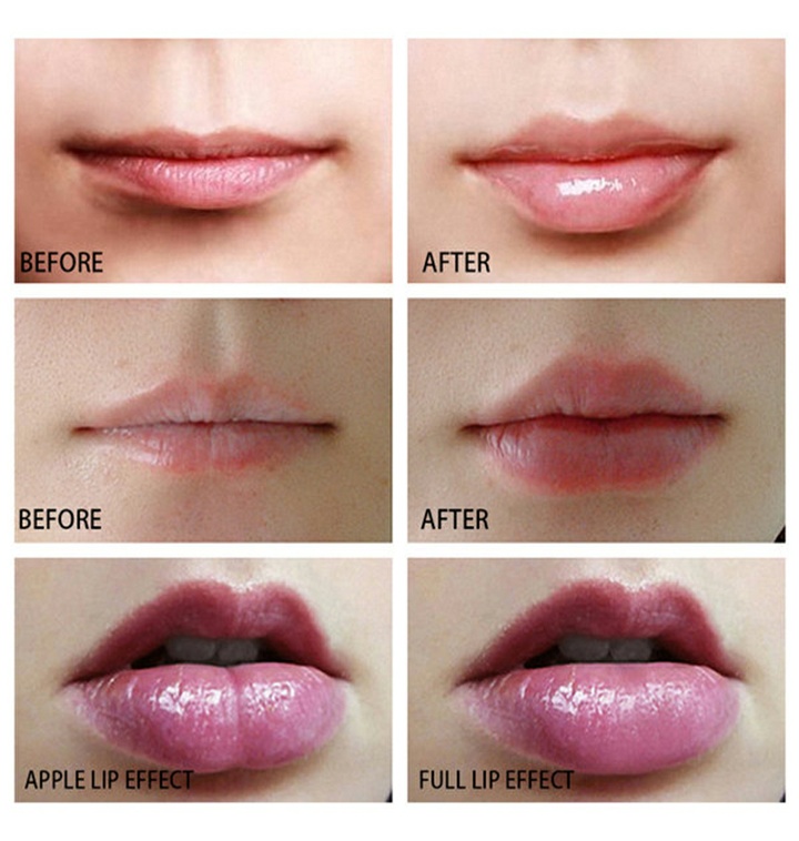 Dailyitem Máy làm dày môi Mexitop Lip Plumper Dailyitem Máy làm dày môi Mexitop Lip Plumper