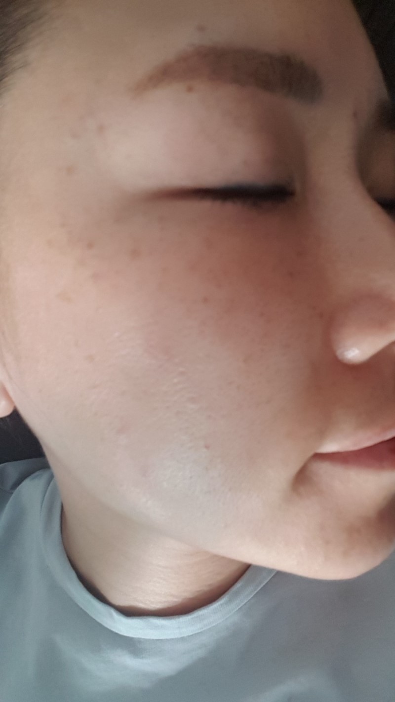 Dongsung Kem trị thâm nám tàn nhang Rannce Max Hydra Whitening Cream 17ml Dongsung Kem trị thâm nám tàn nhang Rannce Max Hydra Whitening Cream 17ml