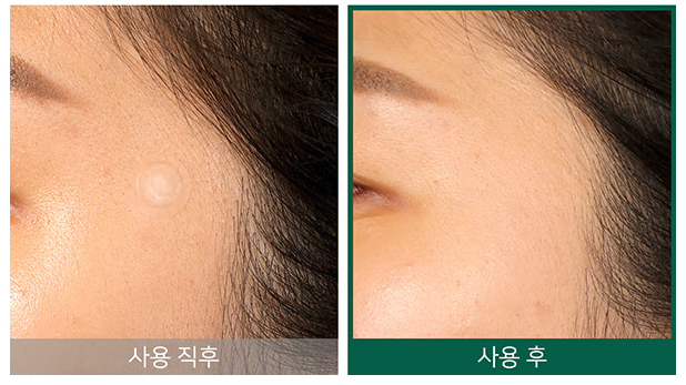 Some By Mi Miếng dán trị mụn Clear Spot Patch 9p + 9p Some By Mi Miếng dán trị mụn Clear Spot Patch 9p + 9p