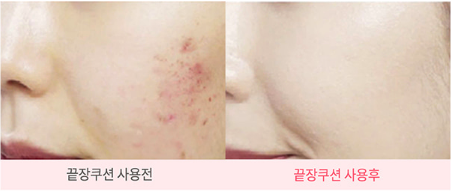 Some By Mi Phấn nước Coverst Moisture Killing Cushion SPF50+ PA+++ 15g Some By Mi Phấn nước Coverst Moisture Killing Cushion SPF50+ PA+++ 15g