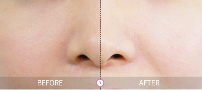 The Yeon Kem trắng da trong 3 giây Yowoo Whiteing Cream 100ml The Yeon Kem trắng da trong 3 giây Yowoo Whiteing Cream 100ml