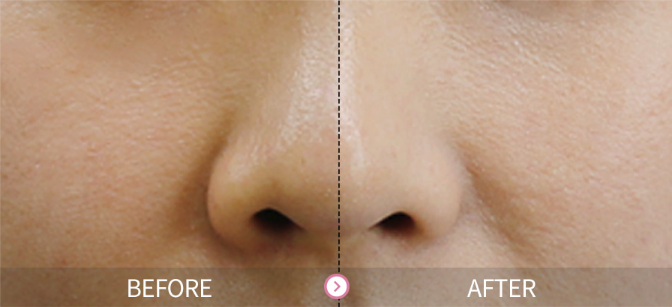 The Yeon Kem trắng da trong 3 giây Yowoo Whiteing Cream 100ml The Yeon Kem trắng da trong 3 giây Yowoo Whiteing Cream 100ml