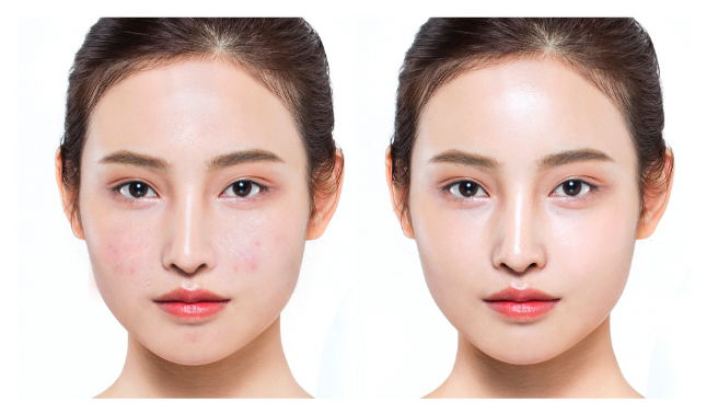 Forencos Che khuyết điểm chống nước Tattoo Waterproof Scar Concealer 3g Forencos Che khuyết điểm chống nước Tattoo Waterproof Scar Concealer 3g