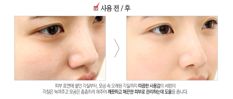So Natural Tinh chất tái tạo da Red Peel Tingle Serum 35ml So Natural Tinh chất tái tạo da Red Peel Tingle Serum 35ml