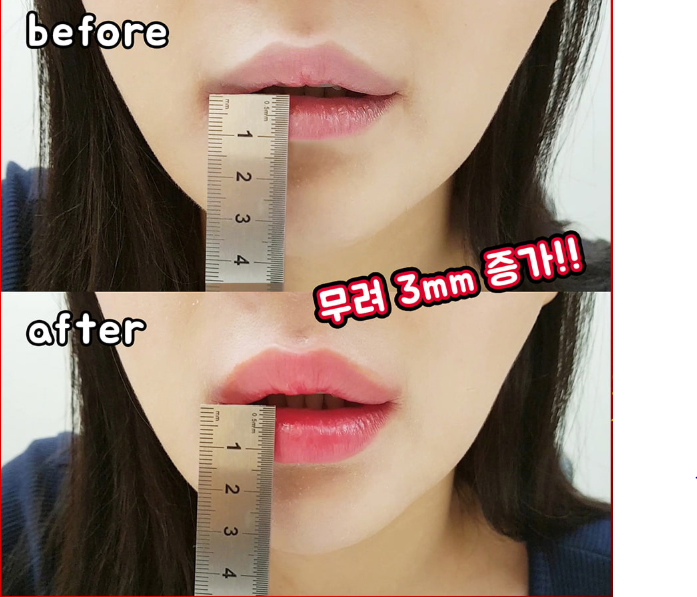 Skinagent Son làm dày môi Hotomi Lip Pump Strong 7g Skinagent Son làm dày môi Hotomi Lip Pump Strong 7g