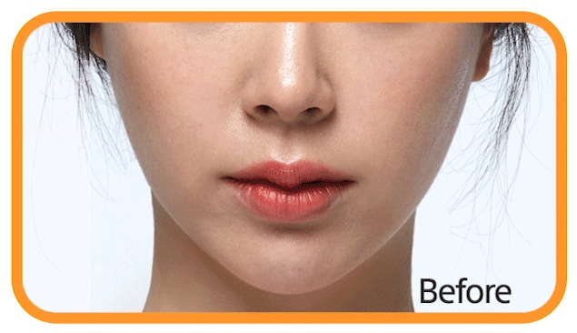 April Skin Real Carrot Blemish Clear Serum 45g April Skin Real Carrot Blemish Clear Serum 45g
