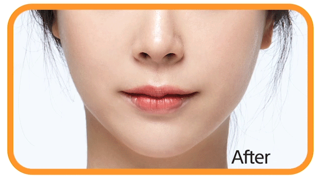 April Skin Real Carrot Blemish Clear Serum 45g April Skin Real Carrot Blemish Clear Serum 45g