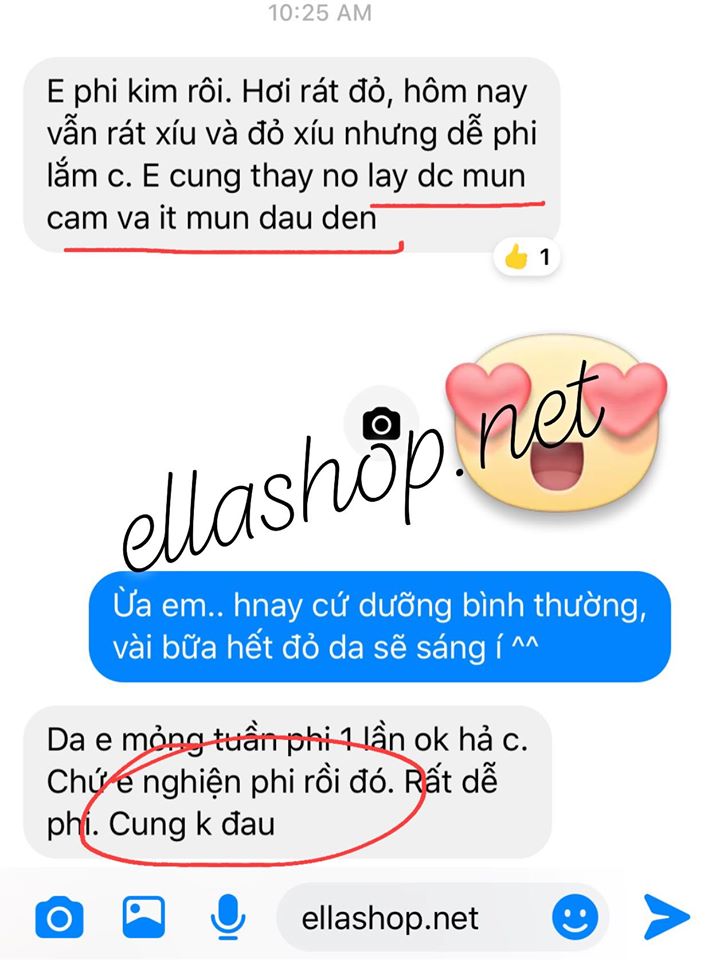 Auto MTS Bút phi kim thông minh MTS Auto MTS Bút phi kim thông minh MTS