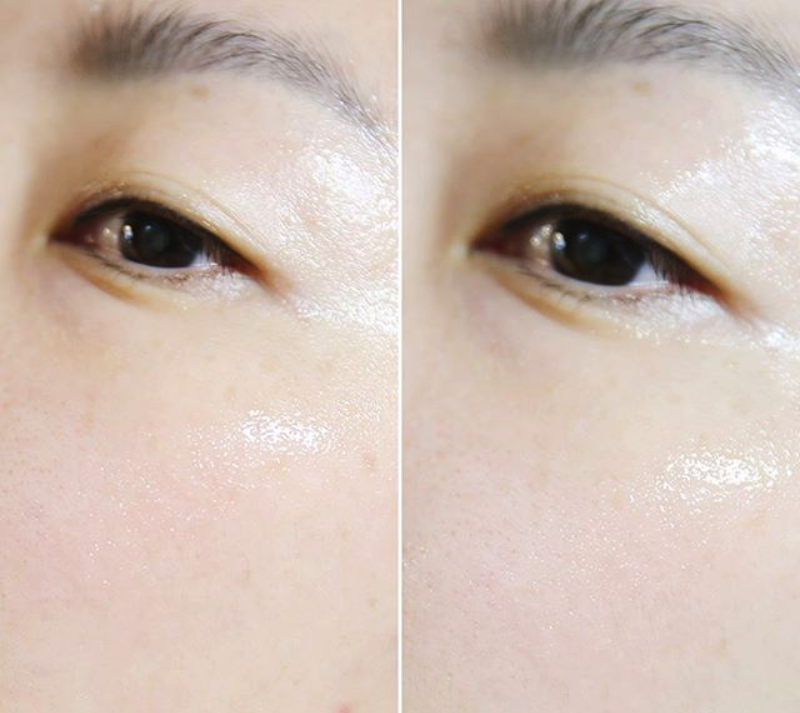 Cellcure Tinh chất dưỡng trắng trị thâm nám White Energy Luminous Ampoule 50ml Cellcure Tinh chất dưỡng trắng trị thâm nám White Energy Luminous Ampoule 50ml