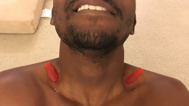Fish Into Collarbone Challenge 