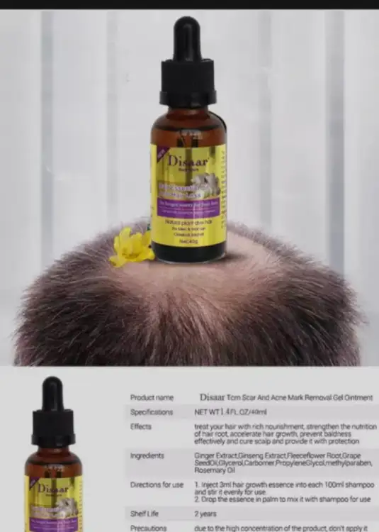 Buy Disaar 30ml Fast Hair Growth Essential Oil Ginger Formula Anti-hair Loss Oil Head Scalp Treatment For Men And Women at Best Price In Bangladesh