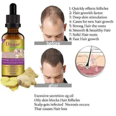 Buy Disaar 30ml Fast Hair Growth Essential Oil Ginger Formula Anti-hair Loss Oil Head Scalp Treatment For Men And Women at Best Price In Bangladesh