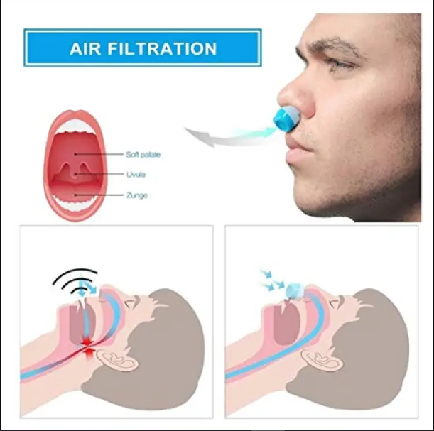 Picture of Anti-Snoring Device For Men and Women