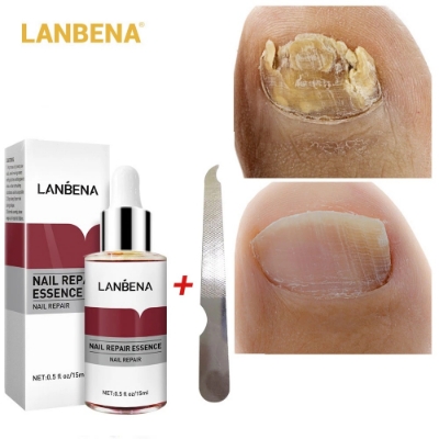 Picture of LANBENA Nail Repair Essence - 15ml