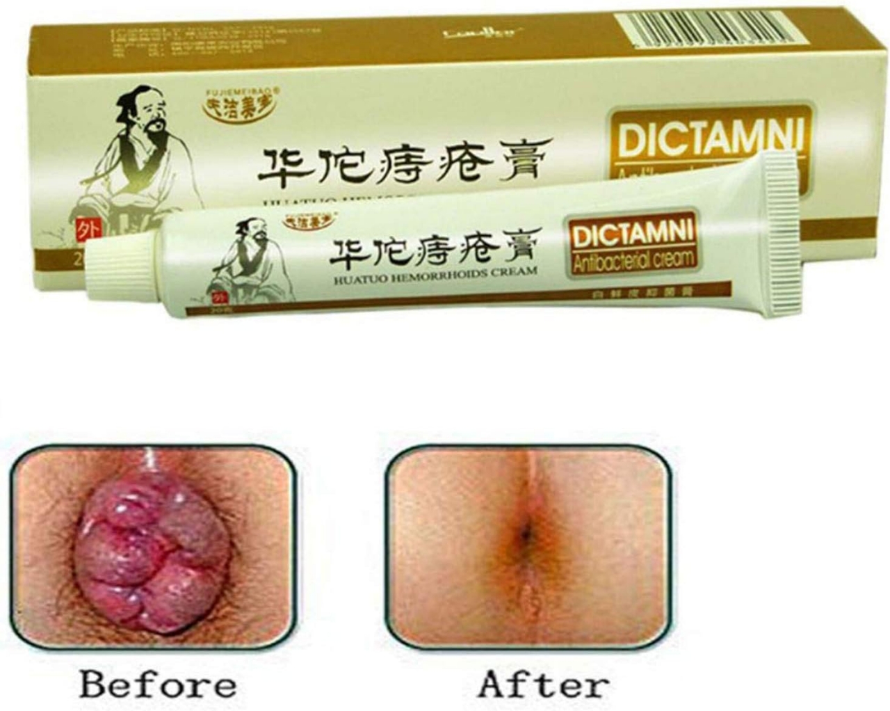 Picture of DICTAMNI Hemorrhoids Herbal Cream 20g 3pcs Combo
