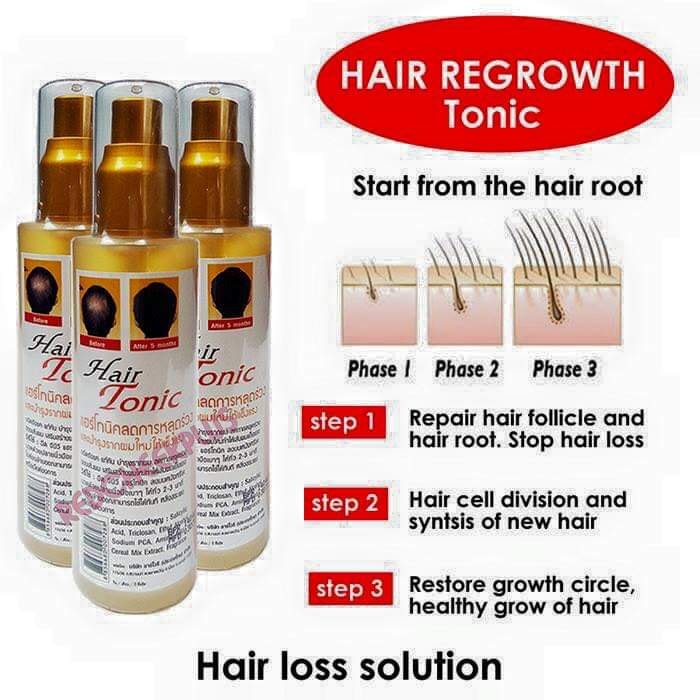 Picture of Genive Natural Hair Tonic Hair Loss Treatment